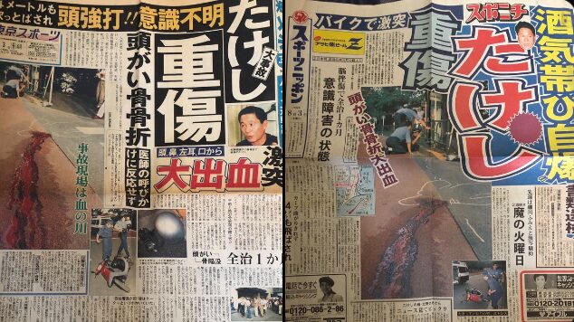 1994年にバイク事故で大けが